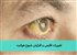 تغییرات اقلیمی و افزایش شیوع هپاتیت